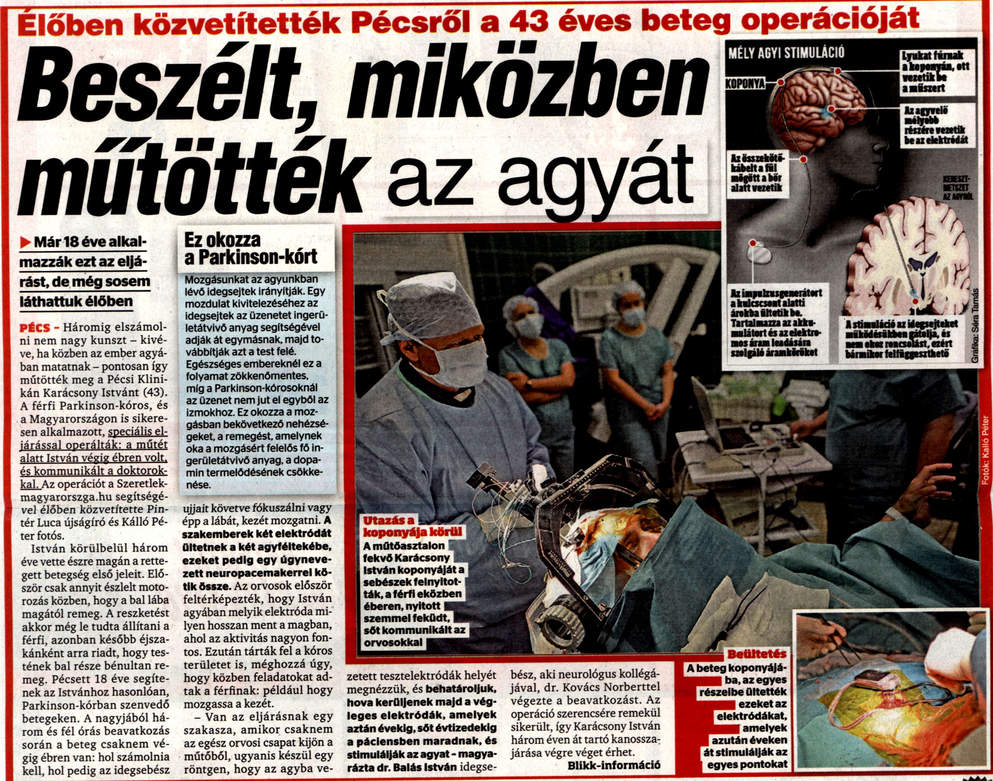 Beszélt, miközben műtötték az agyát Élőben közvetítették Pécsről a 43 éves beteg operációját